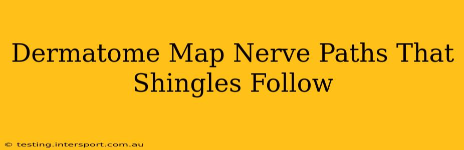 Dermatome Map Nerve Paths That Shingles Follow