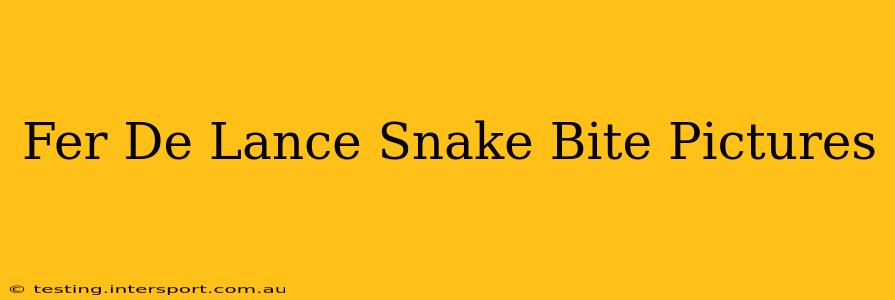 Fer De Lance Snake Bite Pictures